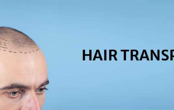 What Are the Benefits of Scalp Micro Pigmentation in Chennai?