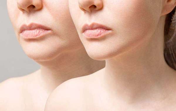 The Primary Focuses of Facial Plastic Surgery